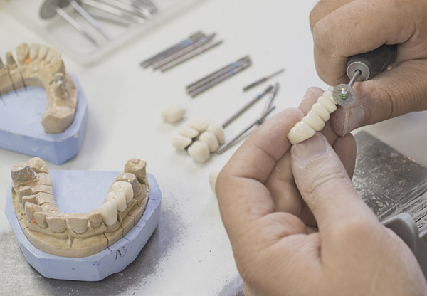 protese dental